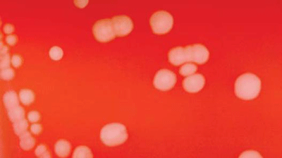 Figure 1 is a picture showing N. meningitidis colonies on blood agar plate (BAP).