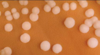 Figure 2 is a picture showing N. meningitidis colonies on chocolate agar plate (CAP).