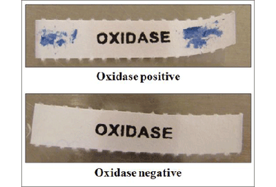 Figure 4 is a picture showing Kovac’s oxidase test: a negative and positive reaction on filter paper.