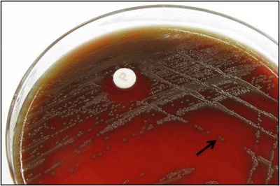 Figure 1 is a picture showing S. pneumoniae colonies with a surrounding green zone of alpha-hemolysis on a blood agar plate (BAP).