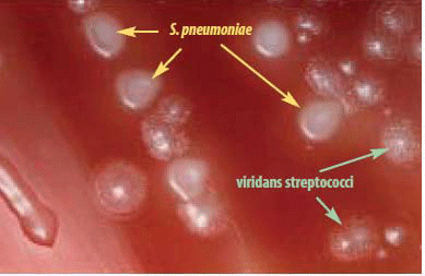 Figure 2 is a picture showing S. pneumoniae colonies have a flattened and depressed center after 24-48 hours of growth on a blood agar plate (BAP), whereas the viridans streptococci retain a raised center.