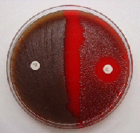 Figure 5 is a picture showing the optochin test for S. pneumoniae using optochin disks. The strain on the left is resistant to optochin with no zone of inhibition, and therefore is not a pneumococcus. The strain on the right is susceptible to optochin and is S. pneumoniae.
