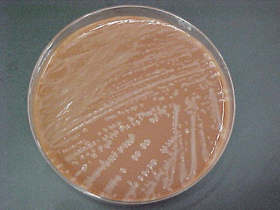 Figure 1 is a picture showing H. influenzae colonies on a chocolate agar plate (CAP).