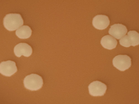 Figure 2 is a picture showing H. influenzae colonies on a chocolate agar plate (CAP).