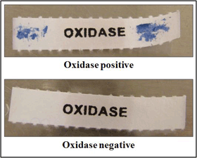Figure 4 is a picture showing Kovac’s oxidase test: a negative and positive reaction on filter paper.