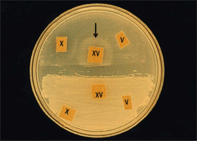 Figure 5 is a picture showing identification of hemin (X factor) and NAD (V factor) as growth requirements using paper disks. The top strain is only growing around the disk containing both hemin and NAD, and is presumptively identified as H. influenzae.