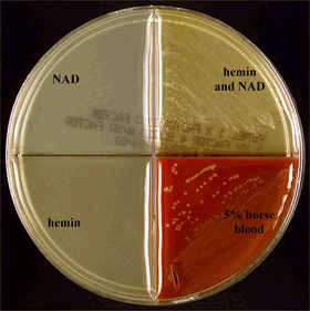 Figure 6 is a picture showing the growth pattern for H. influenzae on a Haemophilus ID Quad plate.