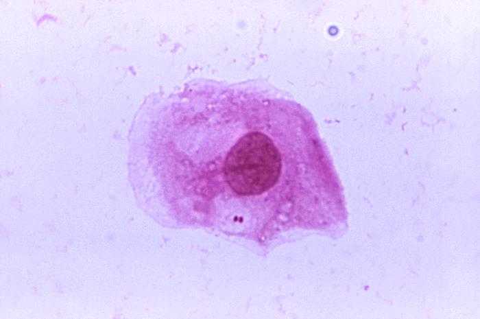 A photomicrograph of Neisseria meningitidis recovered from the urethra of an asymptomatic male; Magnified 1125X.
