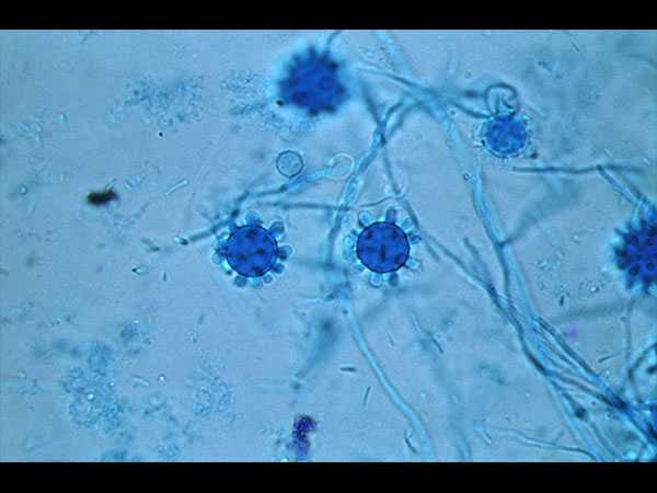 image of a photomicrograph of fungus H. capsulatum, which causes infections called histoplasmosis