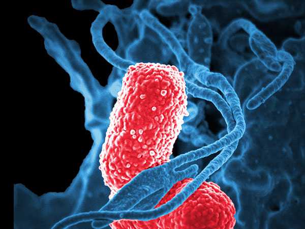 image of Klebsiella is a type of Gram-negative bacteria that can cause different types of healthcare-associated infections, including pneumonia, bloodstream infections, wound or surgical site infections, and meningitis