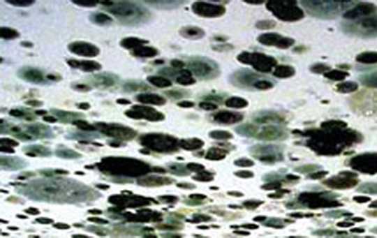 mold in ceiling
