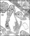 Microfotografía electrónica de transmisión (TEM) de un corte ultrafino, tomada en 1977, mostrando los detalles ultraestructurales de los virus de las paperas con células cultivadas en un cultivo Vero.