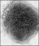 Microfotografía electrónica de transmisión (TEM) con tinción negativa, tomada en 1973, mostrando las características ultraestructurales del virus de las paperas.