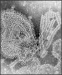 Microfotografía electrónica de transmisión (TEM) con tinción negativa, tomada en 1976, mostrando las características ultraestructurales del virus de las paperas.