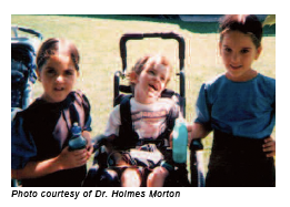 	Photo of three children diagnosed with glutaric aciduria type I