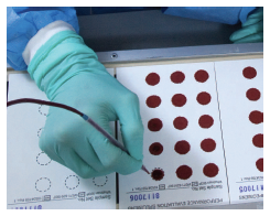 	Photo of blood being spotted by hand onto filter paper that will be used in quality assurance and proficiency tests
