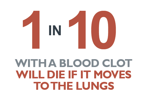 1 in 10 with a blood clot will die if it moves to the lungs
