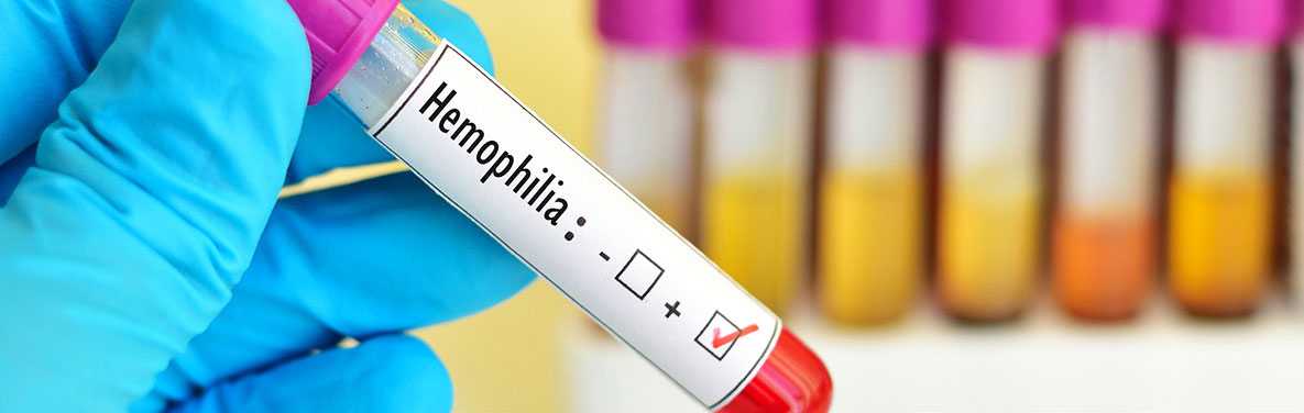 A vial labeled hemophilia