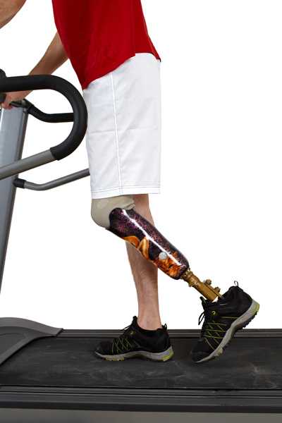 Hombre con pierna prostética caminando en una caminadora