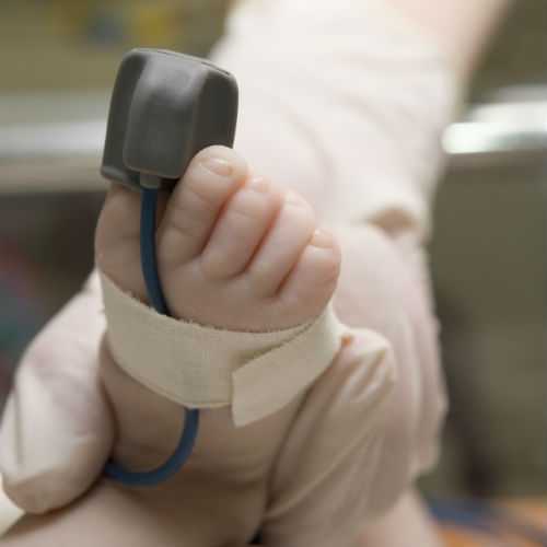 Photo of newborn baby's foot during a pulse oximetry screening