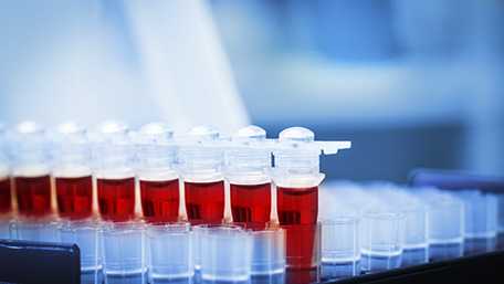 A photo of blood samples 