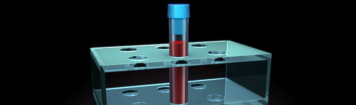 Image of blood in a test tube vial inside of a test tube holder