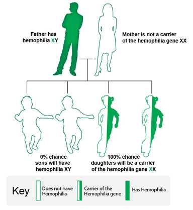 Image: In this example, the father has hemophilia, and the mother does not carry the hemophilia gene. All daughters will carry the hemophilia gene. No sons will have hemophilia.
