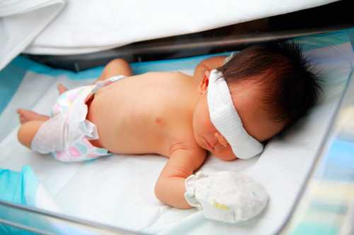 Newborn baby in an incubator wearing an eye shield for protection from photo therapy lamps