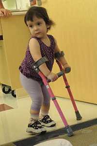 A toddler girl with spina bifida
