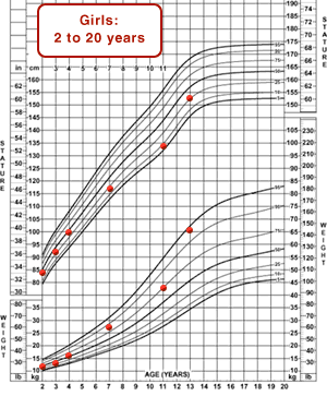 Stature-for-age and weight-for-age chart showing plotted points