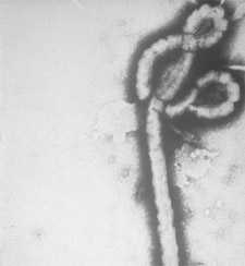Transmission electron micrograph (TEM) image of an Ebola virus virion