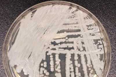 Petri dish with cultured candida auris 
