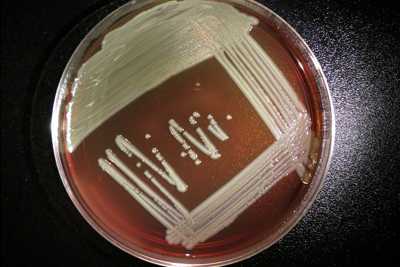 The bacteria Elizabethkingia anophelis is shown as white streaks growing on top of a reddish-brown growth medium in petri dish.