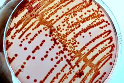 petri dish with red dots in smear pattern 