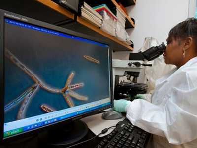 CDC scientist Carol Bolden examining microscopic slides showing Exserohilum rostratum during the 2012 multistate fungal meningitis. A computer screen in the foreground shows the image she is viewing.