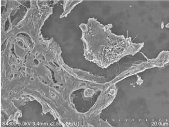 Scanning electron image of carbon nanotubes in a cellular structure.