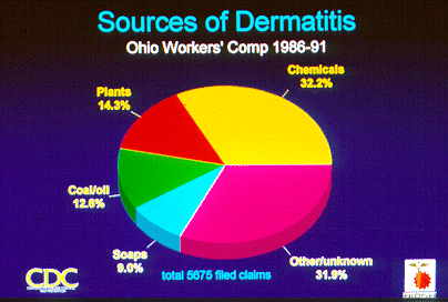 	SLIDE 34 - Sources of Dermatitis