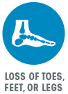 icon-skeletal foot-loss of toes feet or legs