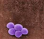Staphylococcus aureus bacteria