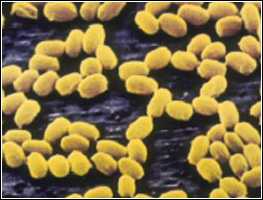Highly magnified photo of Anthrax
