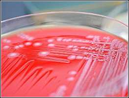 Photo of E. coli in a petry dish