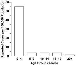 Bar chart shows pertussis cases in age groups of 4 year intervals.