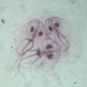 	Giardia trophozoites in a mucosal imprint.