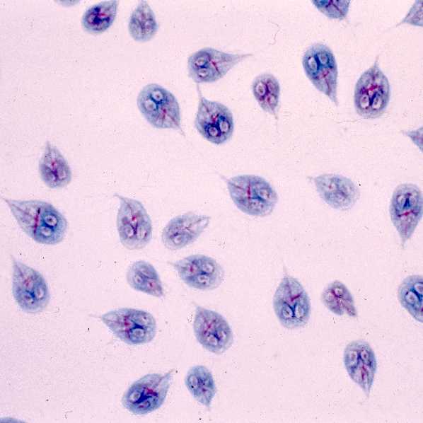 zoonózisos paraziták ppt az emberi test parazitaibol szarmazo celandine