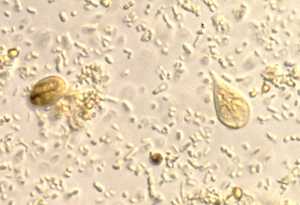 Giardia trophozoites and cysts under a microscope.