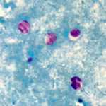 	Cryptosporidium oocysts in a modified acid-fast stain. (CDC Photo; DPDx)