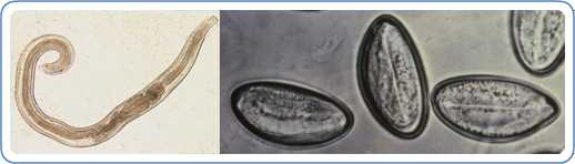 enterobiosis pinworm)