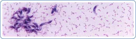 Toxoplasma gondii in mouse ascitic fluid. Smear