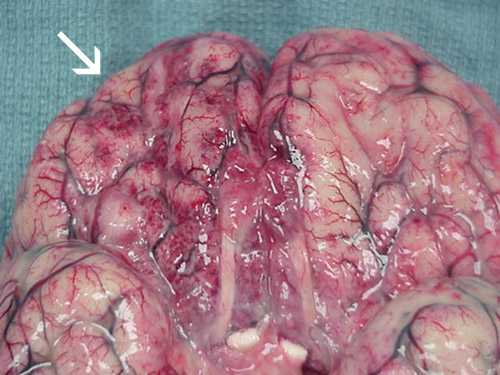 Extensive hemorrhage and necrosis is present in the brain, mainly in the frontal cortex.