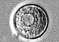 Naegleria cyst under microscope.